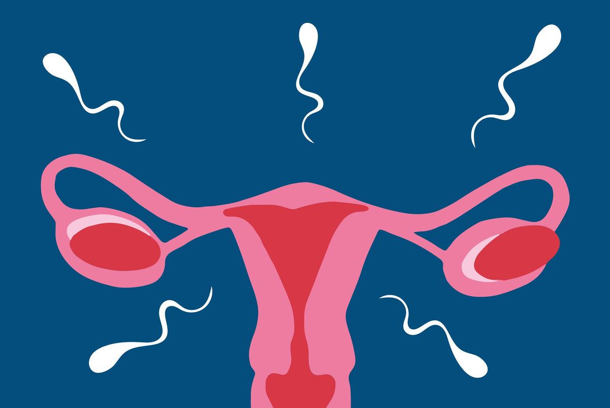 Endometriosis and Its Impact on Infertility